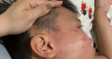 Thầy giáo Ấn Độ bị tố tát học sinh lớp 4 trong lớp học thêm ở Gia Lai