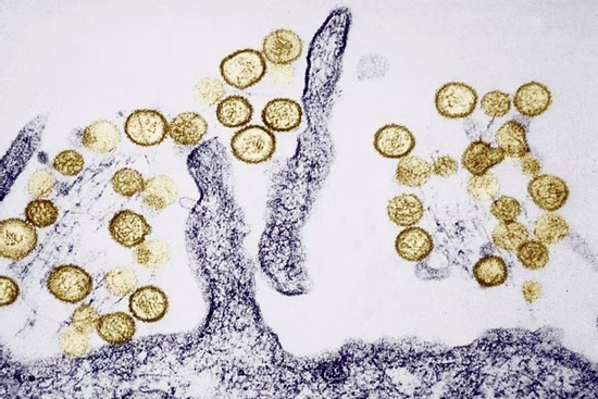 Dịch bệnh bùng phát trên tàu xuyên Đại Tây Dương: Sự nguy hiểm của virus Hanta