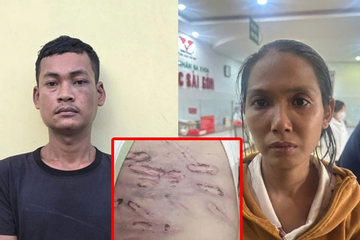 Tạm giữ mẹ và người tình bạo hành bé 2 tuổi ở TP.HCM