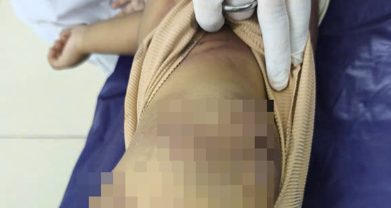 Vụ bé trai 2 tuổi bị mẹ ruột và cha dượng bạo hành: Người thân từ chối chăm sóc