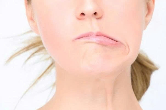 Méo miệng, lệch mặt giữa mùa hè: Nguyên nhân ít ai ngờ tới