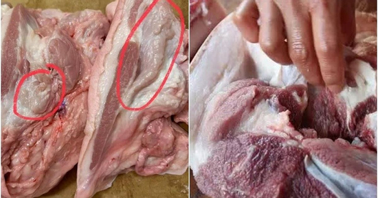 3 phần thịt lợn chứa đầy mầm bệnh nếu sơ chế không đúng cách, nhiều người vẫn ăn thường xuyên