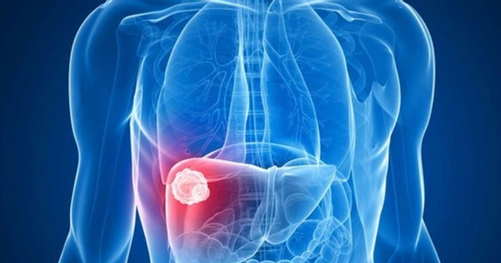 Cơ thể xuất hiện 3 dấu hiệu này, bác sĩ khuyên nên kiểm tra gan càng sớm càng tốt