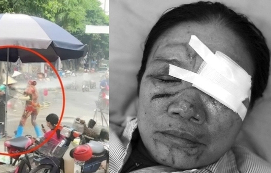 Liên tiếp xảy ra vụ xịt vòi nước cao áp vào người khác, luật sư nói gì?