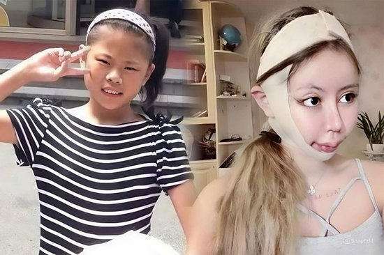 Cô gái chi hơn 15 tỷ đồng phẫu thuật thẩm mỹ để giống thần tượng, trải qua hơn 100 lần “dao kéo” quyết định dừng lại sau khi nhận ra sự thật đáng sợ
