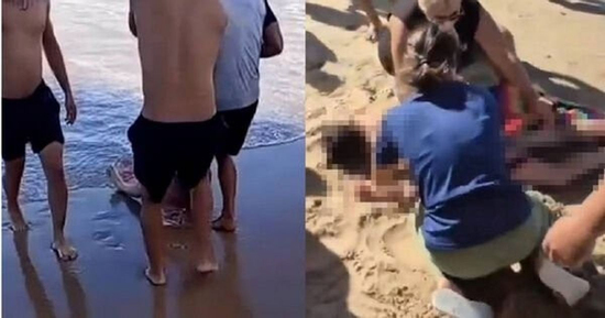 Rùng mình khoảnh khắc cô gái 19 tuổi ở Brazil bị cá mập tấn công, đứt chân phải khi đang tắm biển