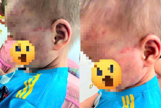 Lời khai của cha dượng vụ đánh con riêng 3 tuổi của vợ, khiến bé phải nhập viện