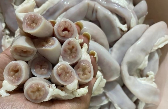 'Lòng se điếu' hình thành từ ruột non nhiễm giun sán, nhiễm độc