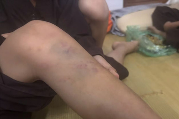 Vụ bạo hành trẻ tại chùa Bầu, Phú Thọ: Nhiều cháu có thương tích