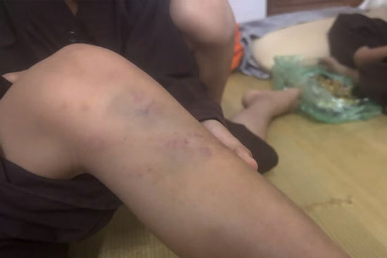 Vụ bạo hành trẻ tại chùa Bầu, Phú Thọ: Nhiều cháu có thương tích