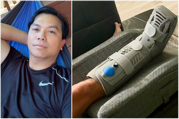 Ca sĩ Mạnh Quỳnh bị vỡ xương mắt cá chân