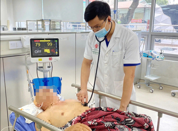 Phòng đột quỵ bằng An Cung: Bác sĩ cảnh báo nguy cơ 'đánh mất cơ hội sống'