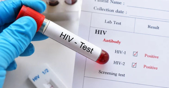Cô gái 29 tuổi sụp đổ khi cầm kết quả dương tính HIV, chi tiết 