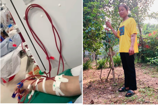 Cô gái suy thận trước ngày cưới, 10 năm chồng đồng hành không một lời nặng nhẹ